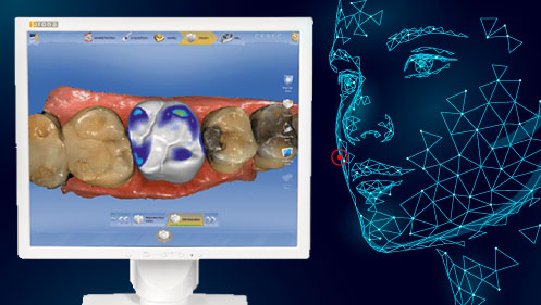 3D digital dental impressions 